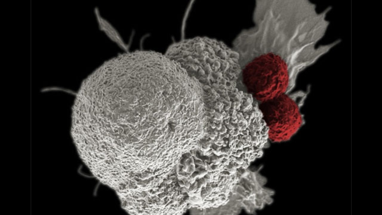 Plant Virus and Antibody Combination Clears Colon Cancer in Mouse Study