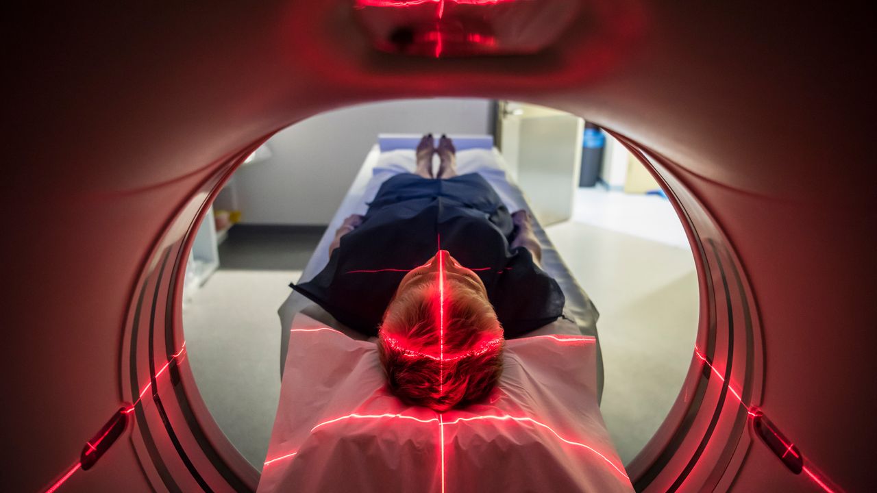 Single Brain Scan Could Diagnose Alzheimer's Disease