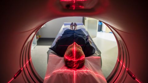 Single Brain Scan Could Diagnose Alzheimer's Disease