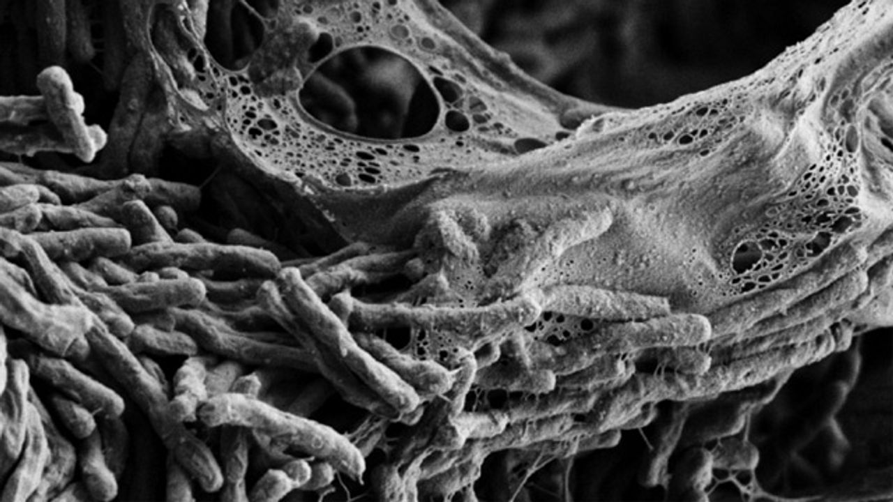 <i>Mycobacterium tuberculosis</i> Cells