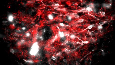 Newly Discovered Brainstem Circuit Knocks Out Nausea