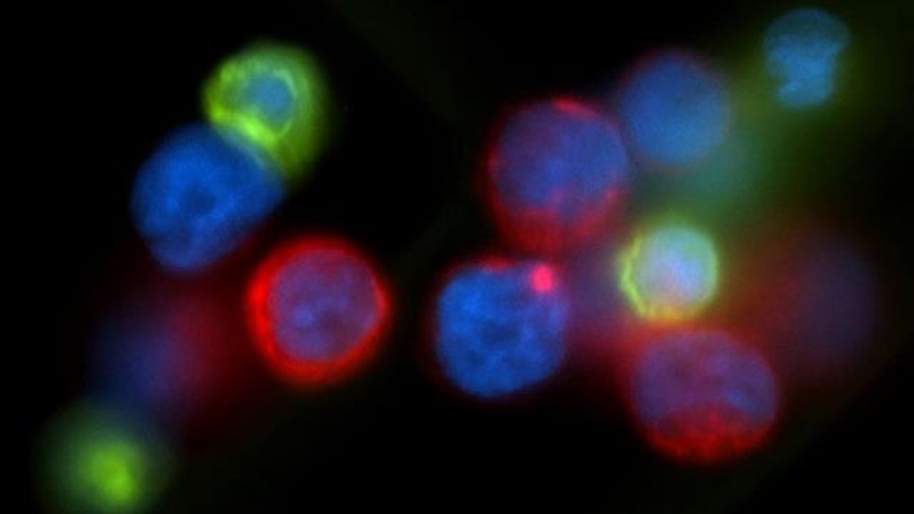 Breast Cancer Metastasis Accelerates During Sleep