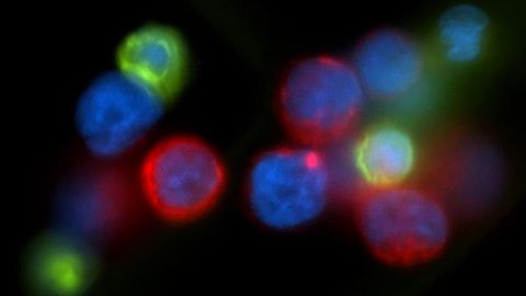 Breast Cancer Metastasis Accelerates During Sleep
