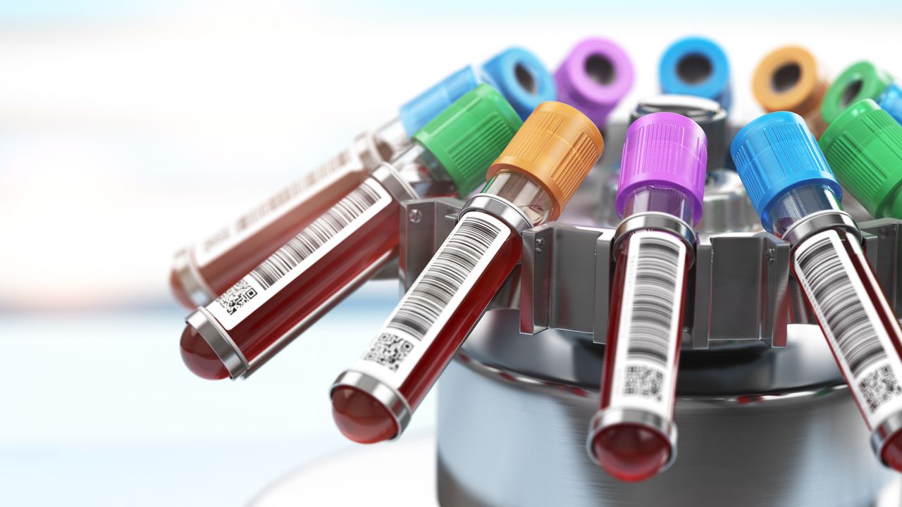 Liquid Biopsy Detects Breast Cancer DNA in Just Five Hours