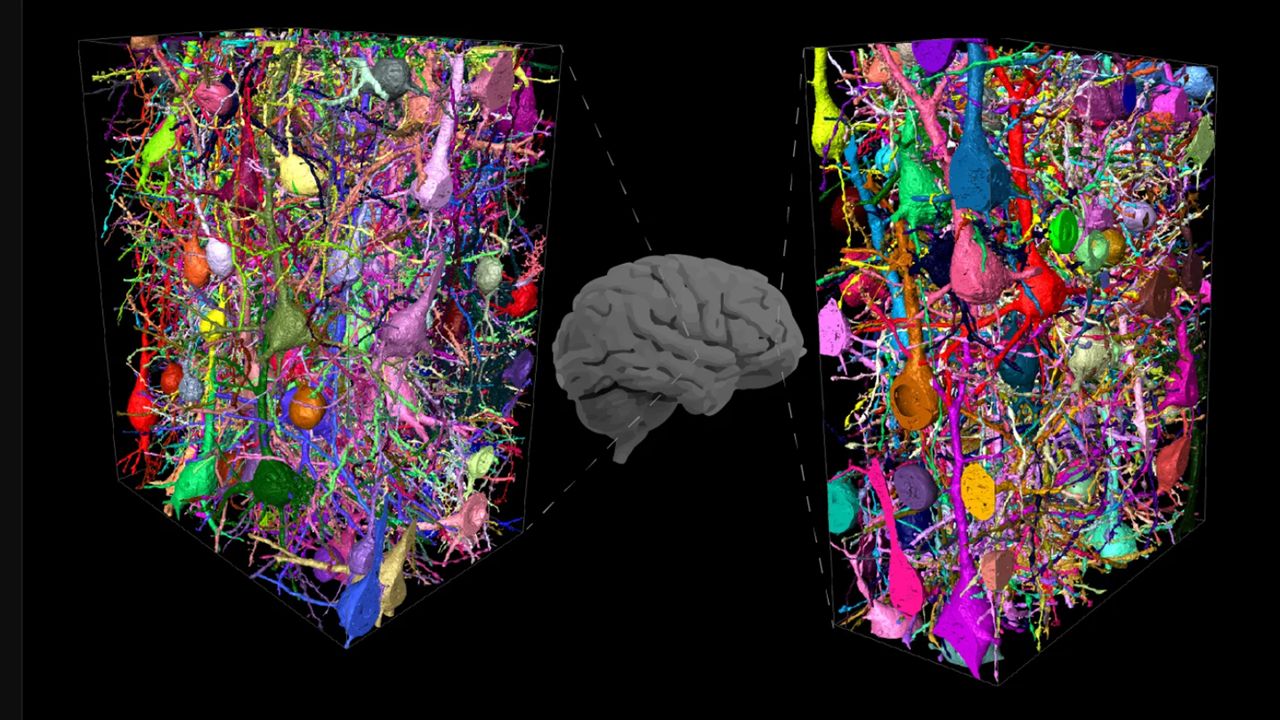 What Makes the Human Brain More Complex?