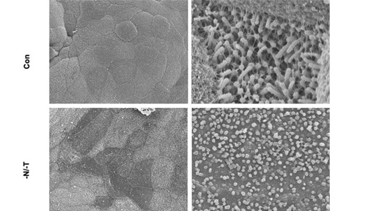 Novel Intestine Chip Provides Insights Into Environmental Enteric Dysfunction