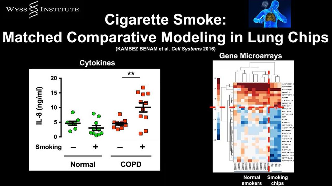 Human Organs-on-Chips for Disease Modeling, Drug Development and Personalized Medicine