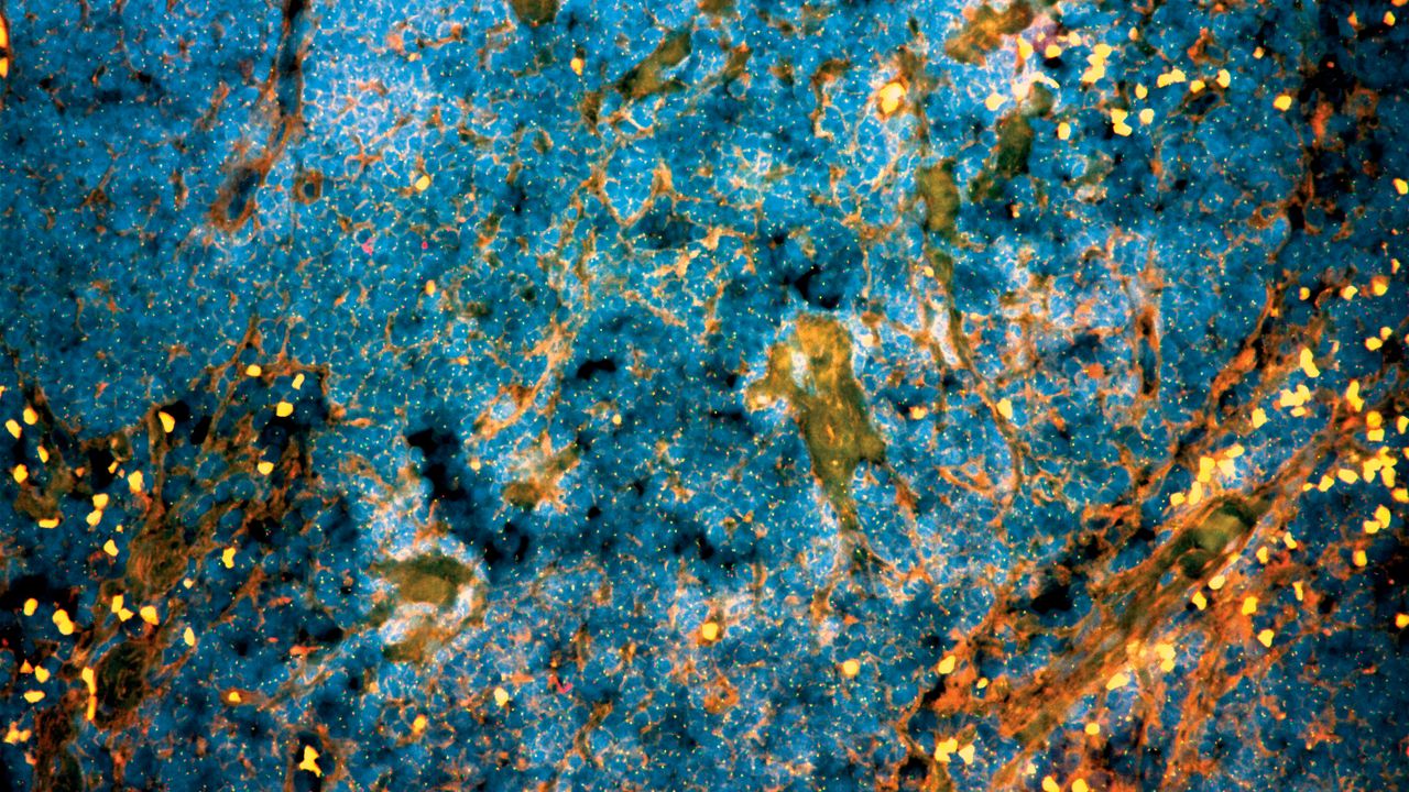 Prostate Cancers Hijack Our Circadian Rhythm To Evade Anti-Hormonal Therapy