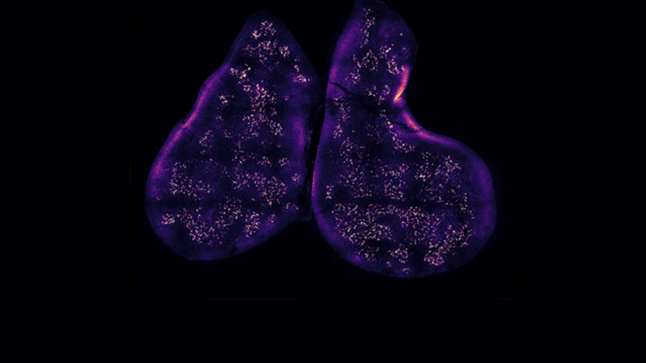 How Immune Cells Learn To Tell Friend From Foe