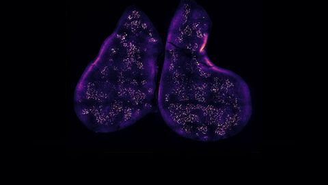 How Immune Cells Learn To Tell Friend From Foe