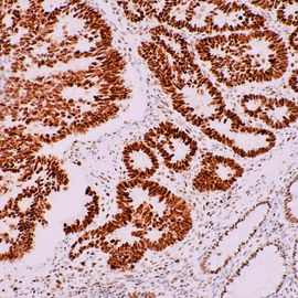 https://assets.technologynetworks.com/production/dynamic/images/content/363107/immunohistochemistry-techniques-strengths-limitations-and-applications-363107-270x270.jpg