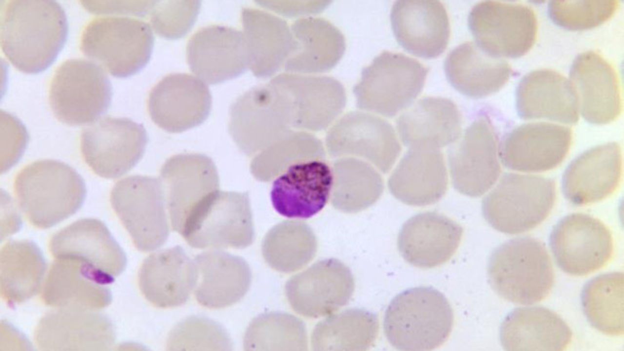 Digital PCR Could Help Select the Best Rapid Malaria Test for an Area