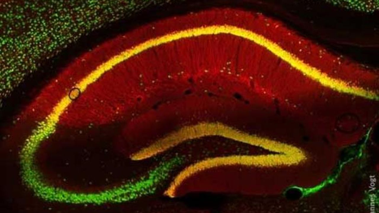 Neuron-Targeting Approach Stops Obese Mice From Binge-Eating