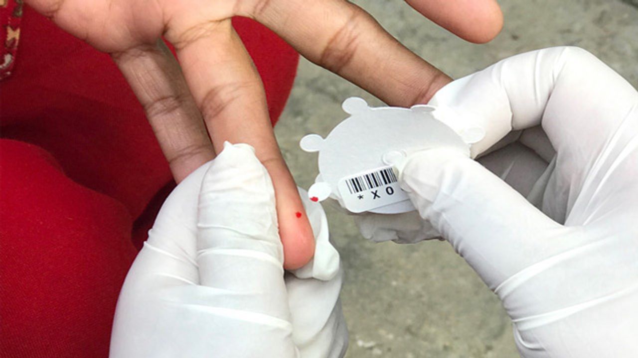 New Technique Detects Typhoid Infections Faster