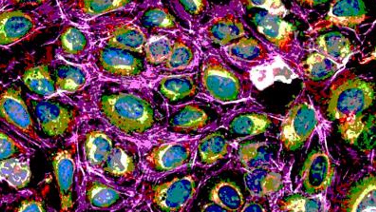Cell Painting – Phenotypic Drug Discovery Re-Imagined