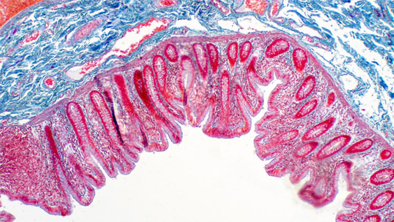 3D Cell Culture: Will Organoids Add a New Dimension to Disease Modeling?