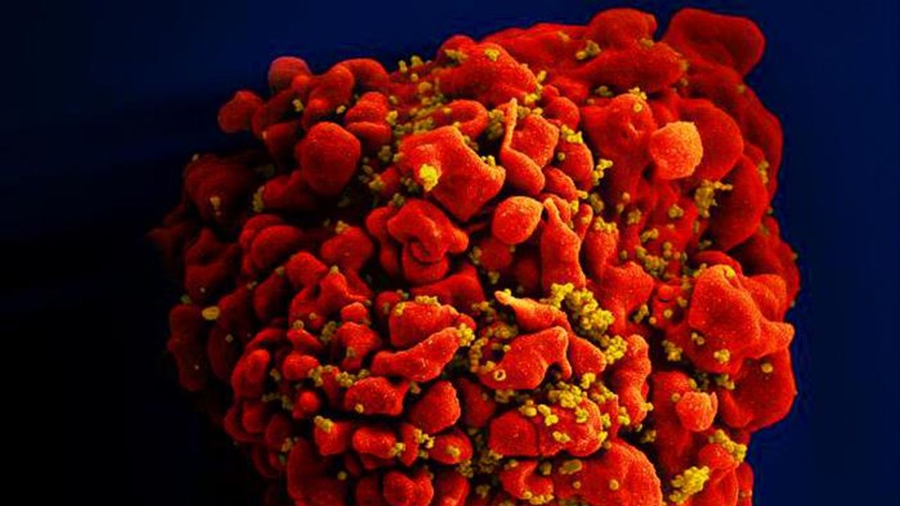 Body’s Aging Processes Speed Up Soon After HIV Infection