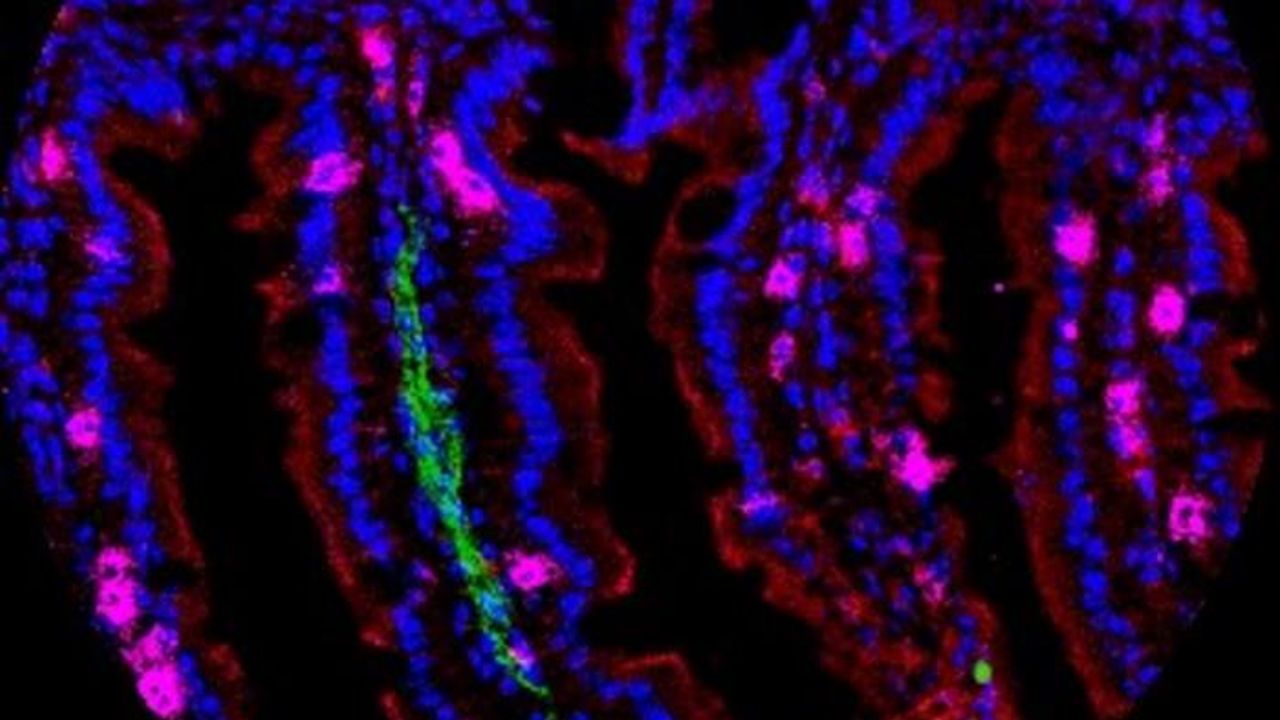 Tissue-Anchored Immune Cells Offer Unique Defenses Against Infections and Malignancies