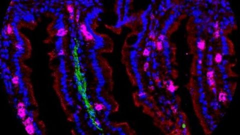 Tissue-Anchored Immune Cells Offer Unique Defenses Against Infections and Malignancies