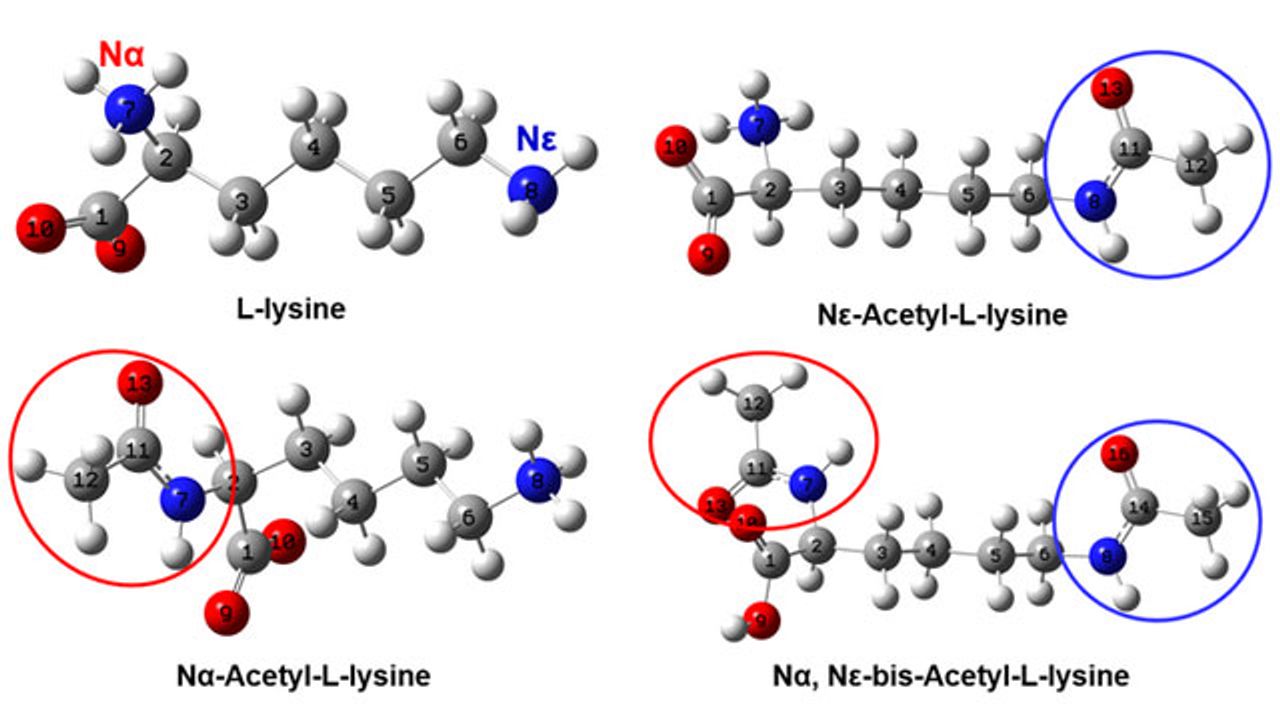 Vibrational Spectroscopy Provides Clues About Protein Acetylation Structures in Biological Systems