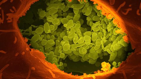 Artificial Intelligence Detects New Family of Genes in Gut Bacteria