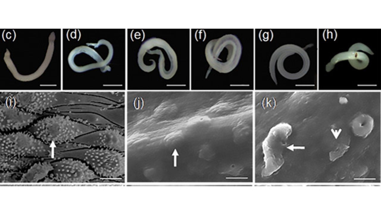 Experts Warn Novel Treatments for Parasitic Worm Diseases Are Needed