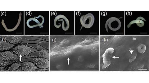 Experts Warn Novel Treatments for Parasitic Worm Diseases Are Needed