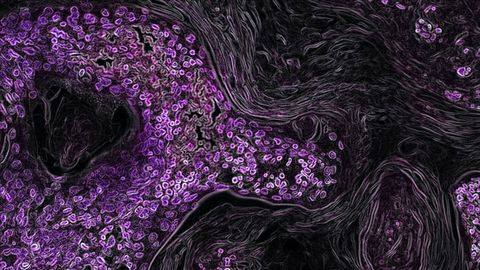 Genes That Increase Likelihood of Cancer Outlined in New Research