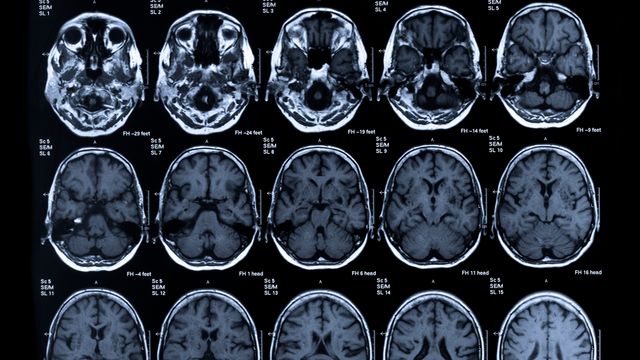 The results of a brain scan. 