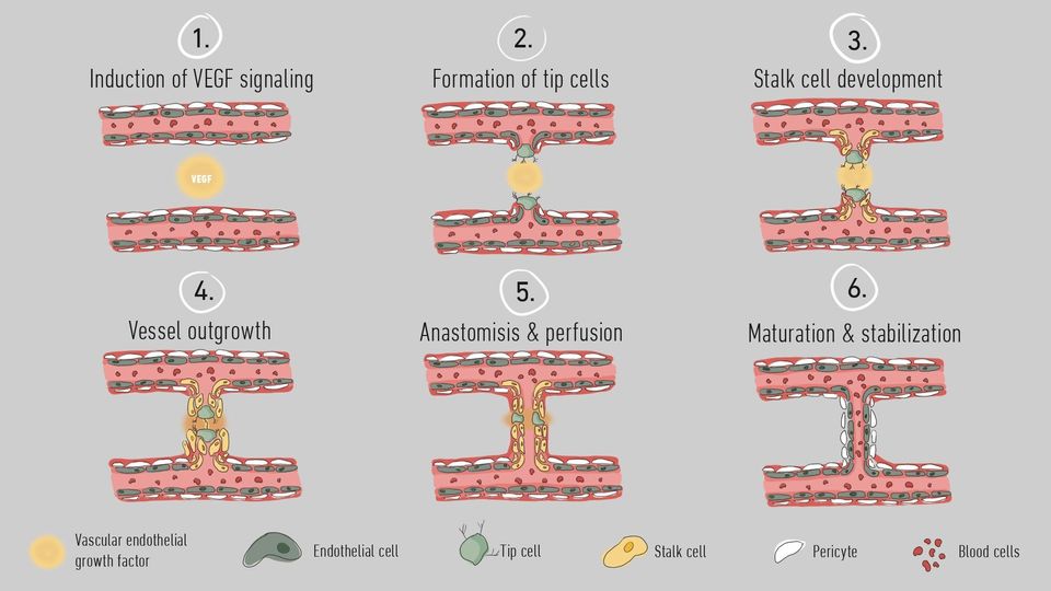 A graphic outlining the six stages of angiogenesis.