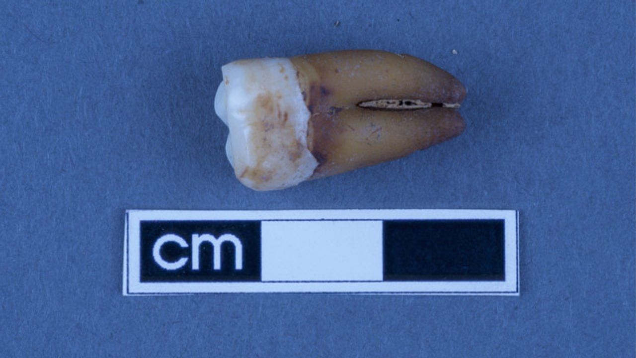 Tooth Analysis Offers a Peek at South Australia’s Early Colonial History