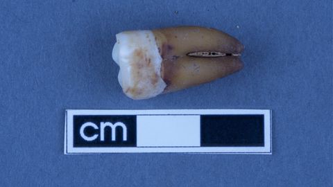 Tooth Analysis Offers a Peek at South Australia’s Early Colonial History