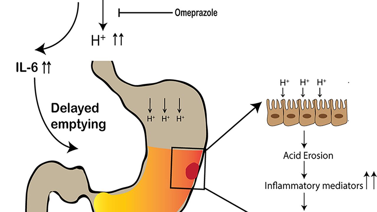 Study Identifies How Opioids Cause Gastrointestinal Problems