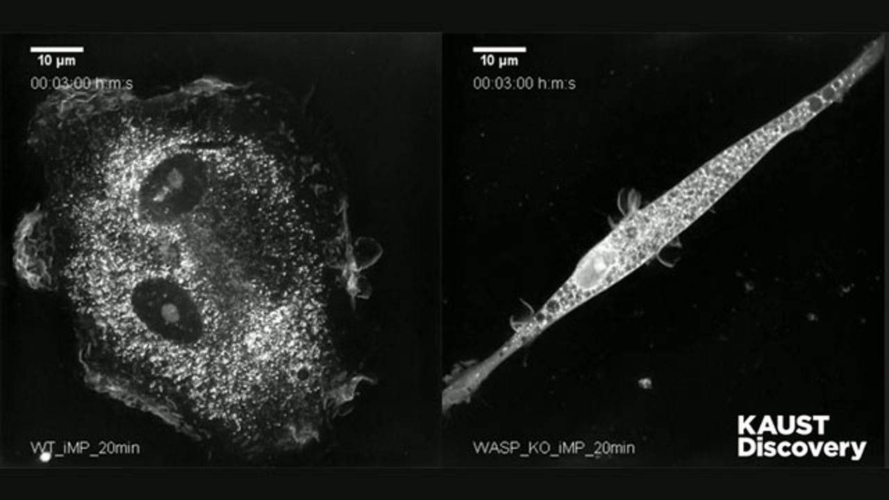 Underpinnings of Rare Immune Disease Revealed by Stem Cells