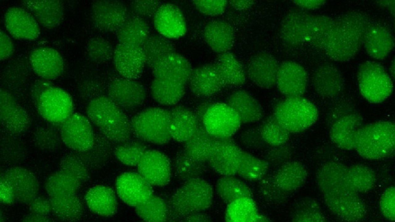 New Technique Visualizes Gene Expression in Mouse Brains in Real-Time