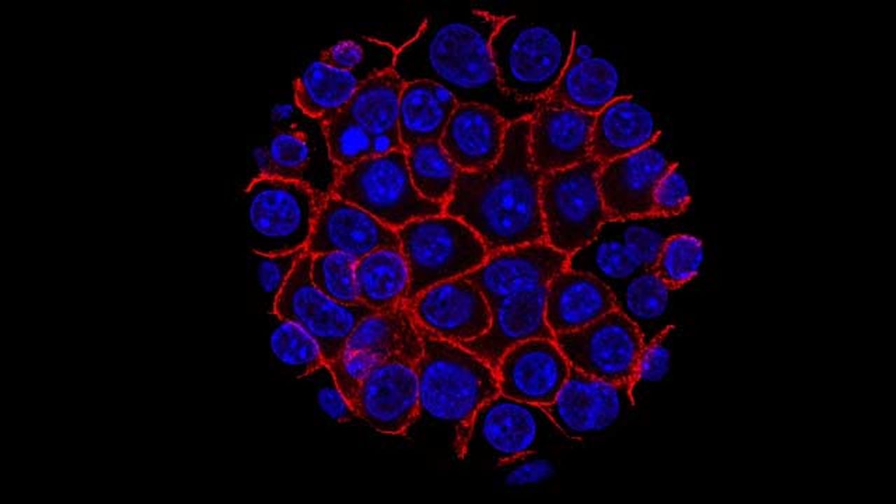 Successful Preclinical Study for Pancreatic Cancer Three-Step Treatment