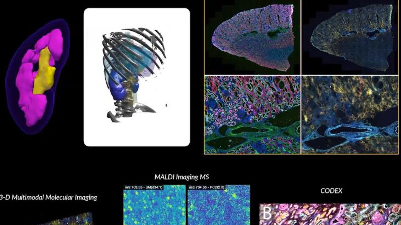 Multimodal Imaging Mass Spectrometry: Advanced Technologies for Molecular Mapping of Biological Tissues
