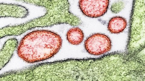 Clinical Trial of mRNA Nipah Virus Vaccine Launched