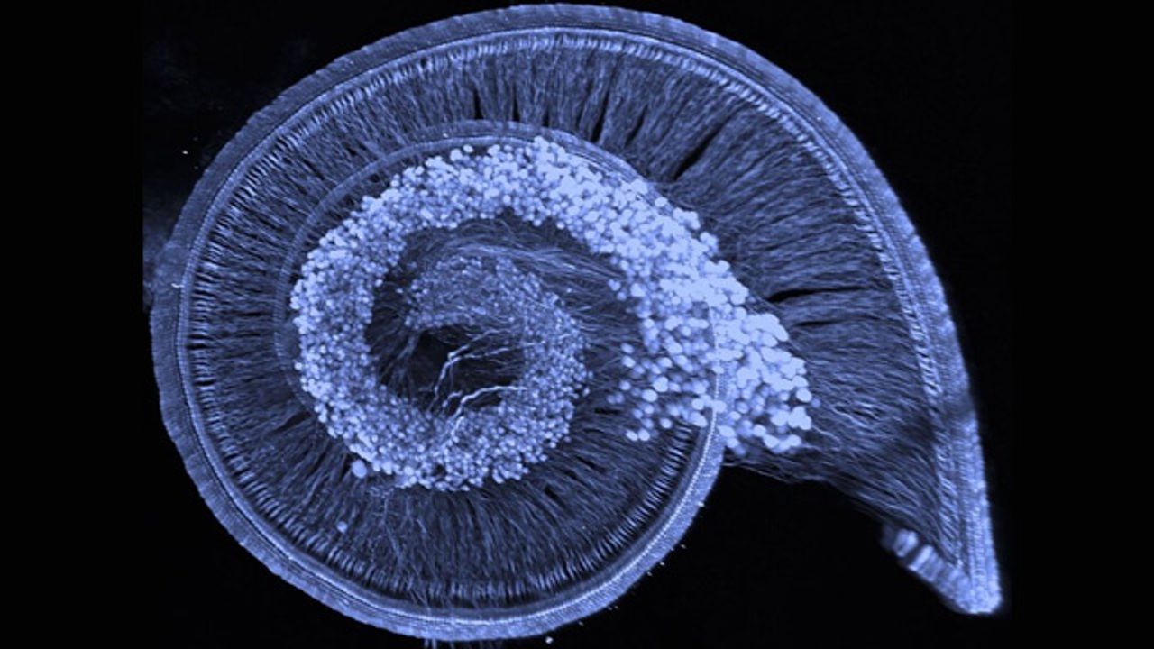 Subtypes of Auditory Neurons Emerge Prior to Birth in Mice