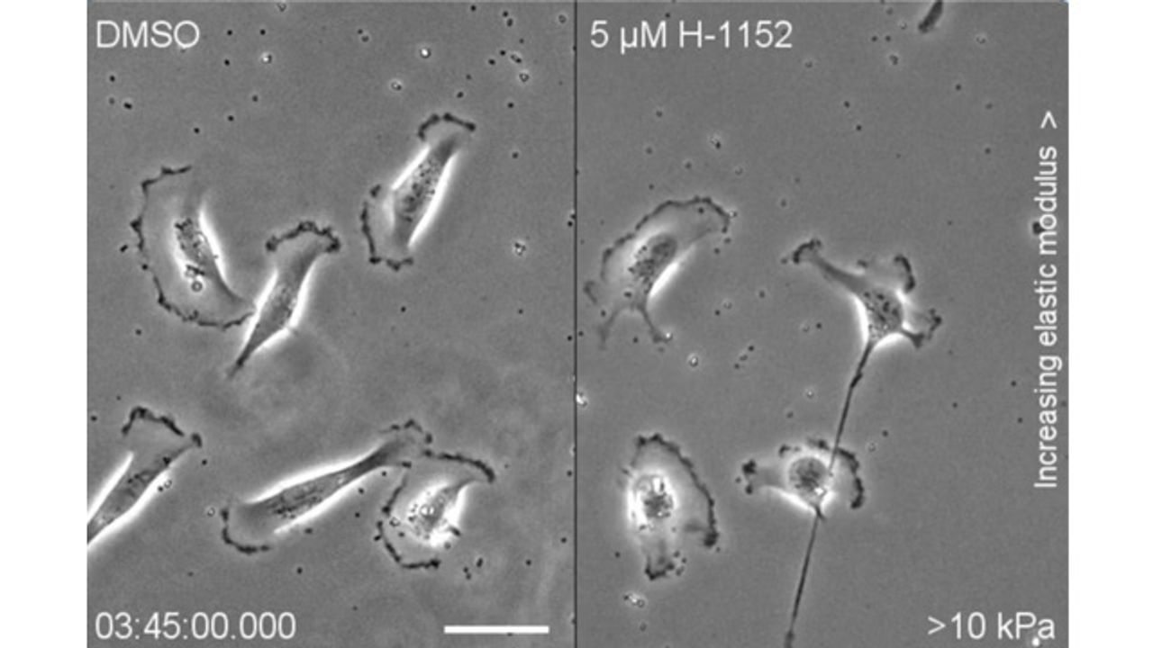 Cancer Cells Migrate Towards “Sweet Spot” Environments