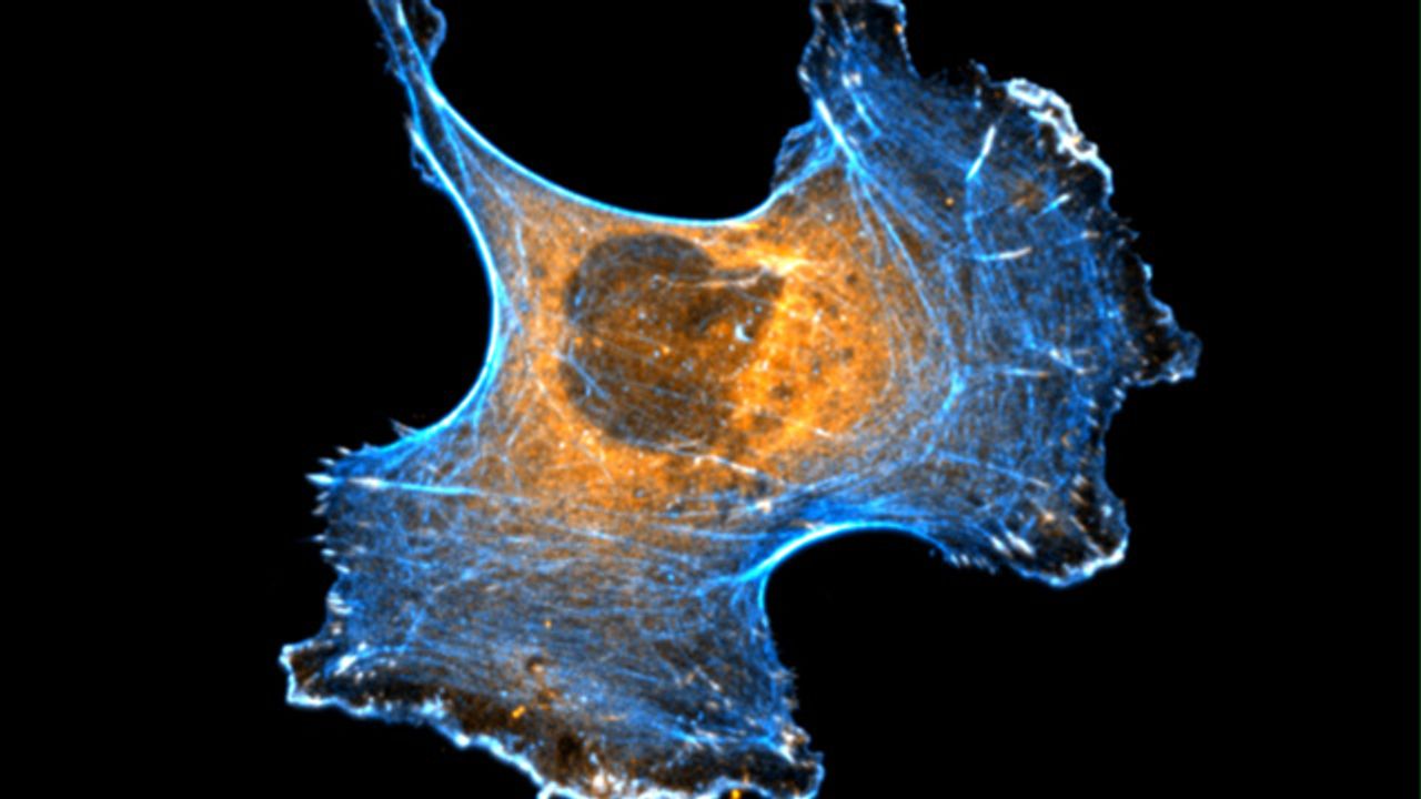 Human Breast Cancer Cell