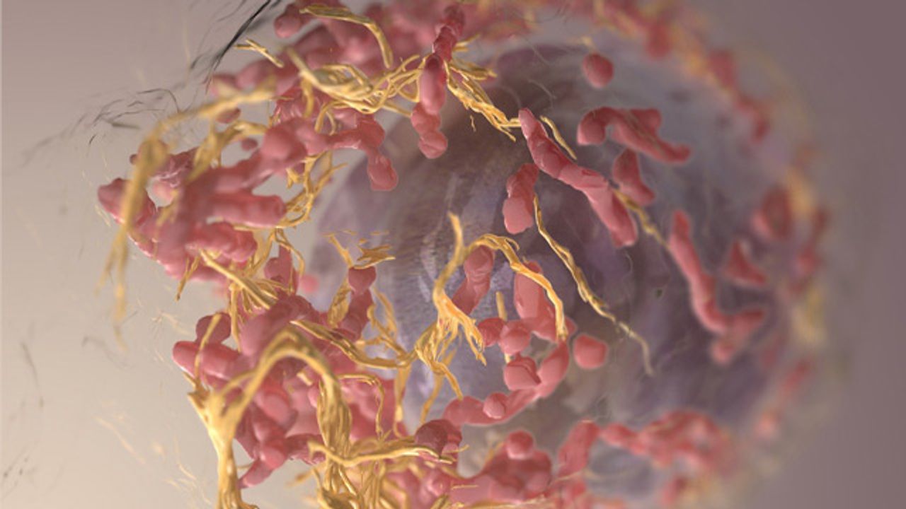 Surgical Dressing Prevents Melanoma Recurrence and Promotes Healing