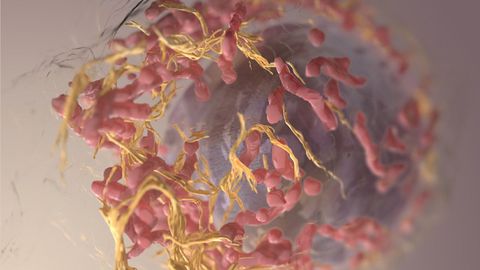 Surgical Dressing Prevents Melanoma Recurrence and Promotes Healing