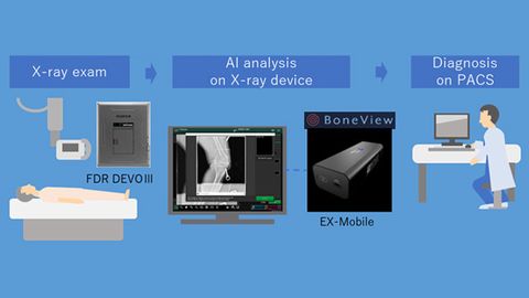 Fujifilm Integrates AI Software To Help Identify Bone Trauma at Point-of-Care