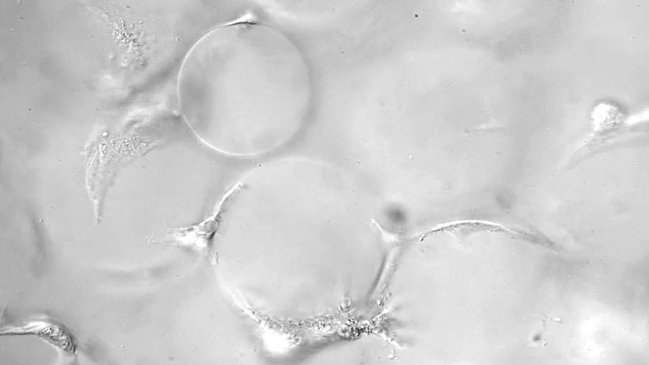 Time-Lapse Footage Shows Neural Stem Cells Grow in 3D Scaffolds
