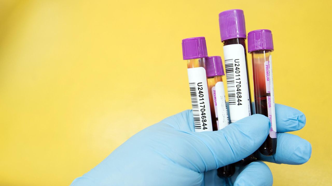 New Marker Efficiently Detects Circulating Tumor Cells