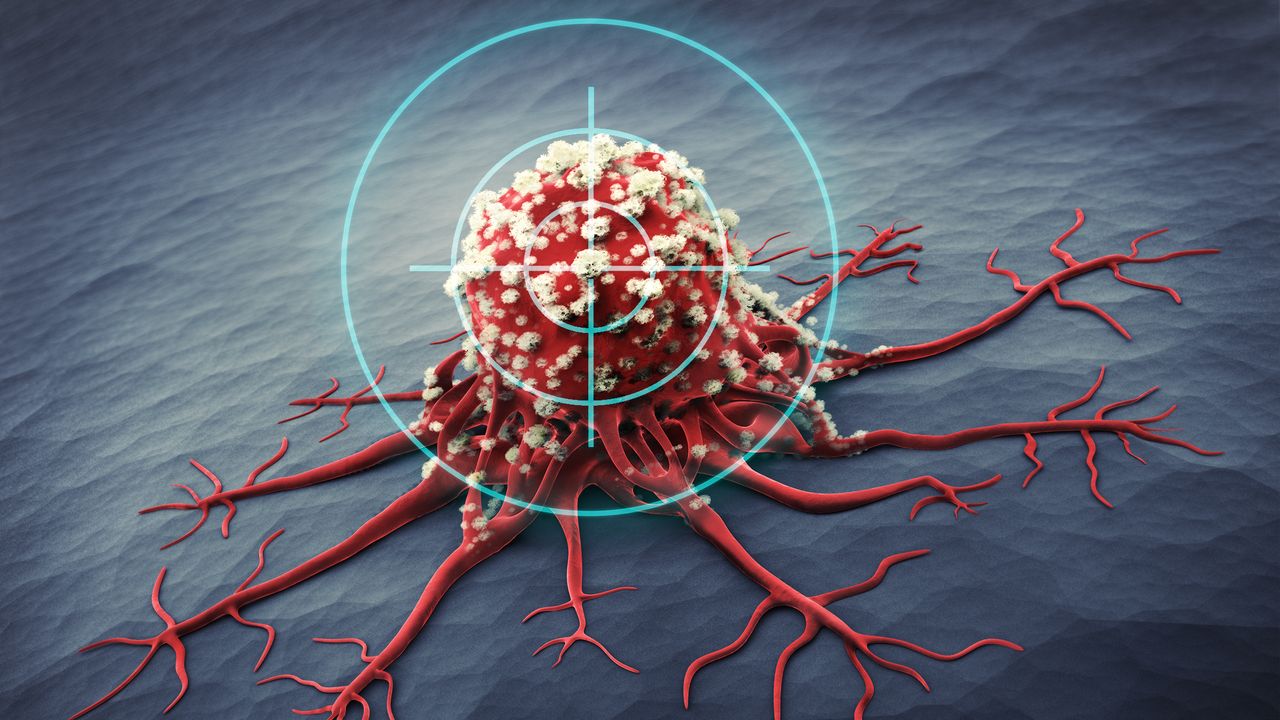 Discovery Aids Identification of Poor Prognosis Prostate Cancers