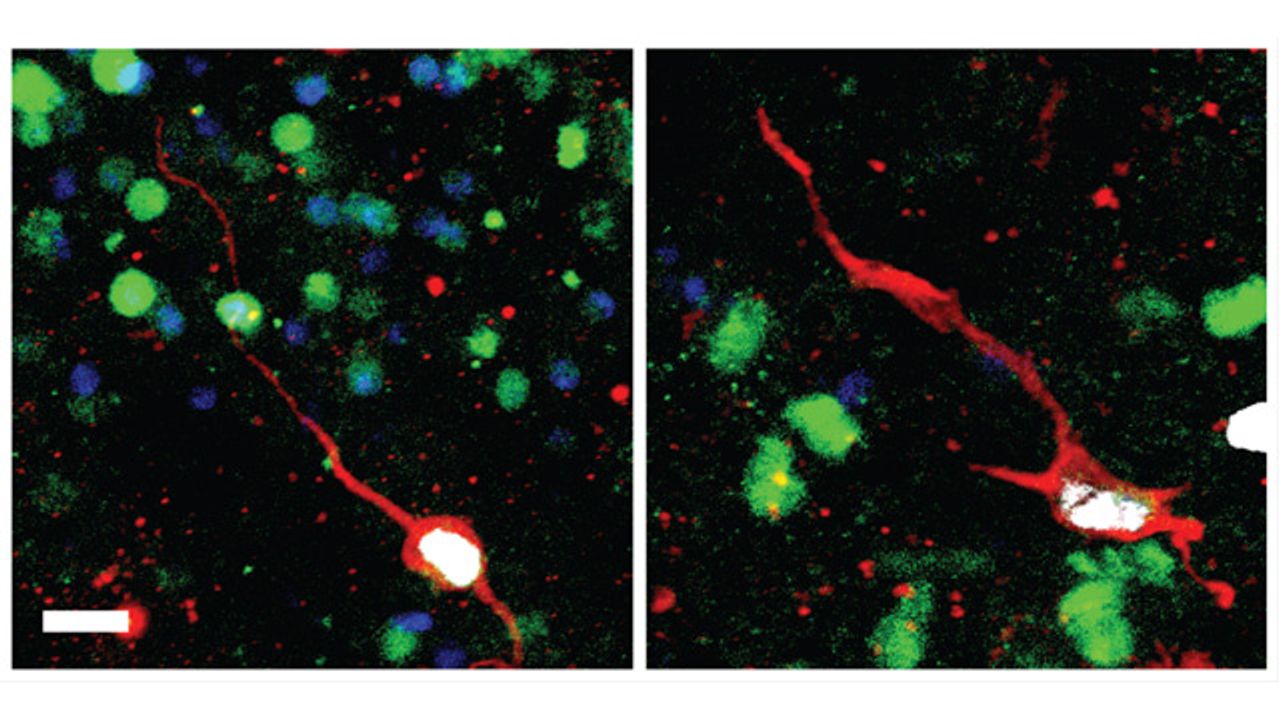 Molecular Signatures of Immature Neurons Provide New Insights Into Brain Plasticity