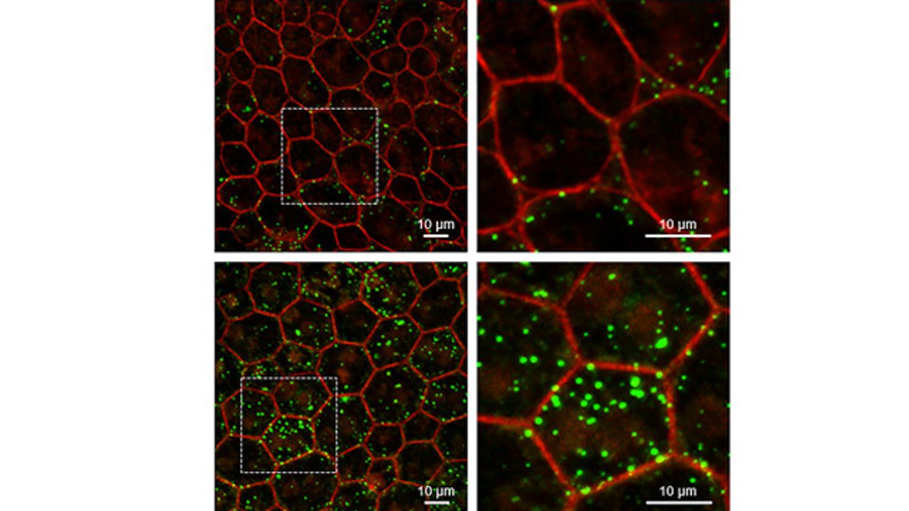 Loss of “Youth” Protein May Drive Aging in the Eye