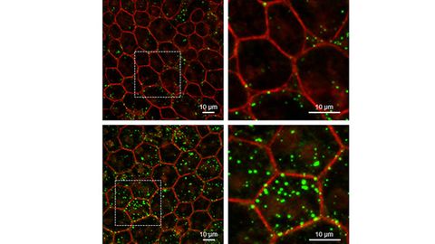 Loss of “Youth” Protein May Drive Aging in the Eye